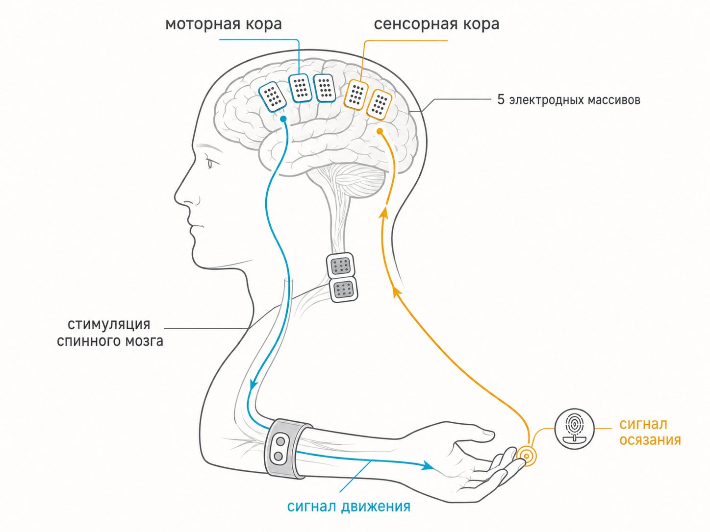схема двойного нейронного обхода